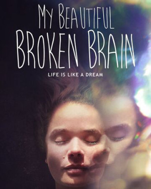 Khối óc xinh đẹp tội nghiệp của tôi - My Beautiful Broken Brain